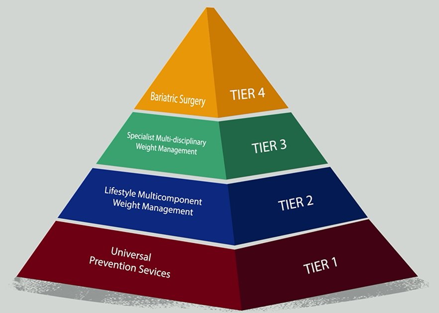There are different levels of weight management services - tier 1 universal prevention services, tier 2 lifestyle multicomponent weight management, tier 3 specialist multi-disciplinary weight management and tier 4 bariatric surgery 