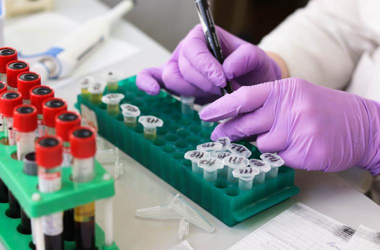 Lab worker testing samples